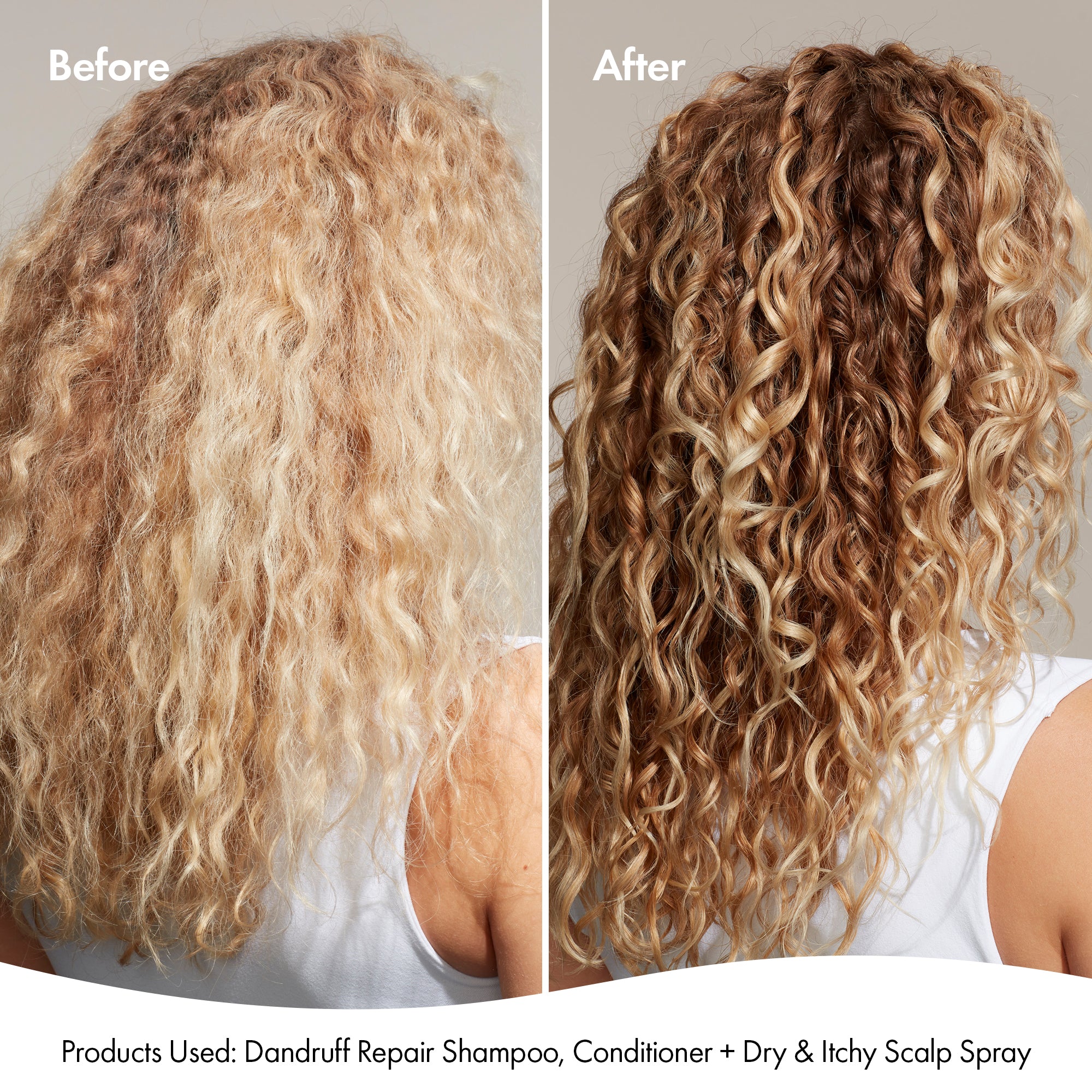 DANDRUFF CONDITIONER - Image 4