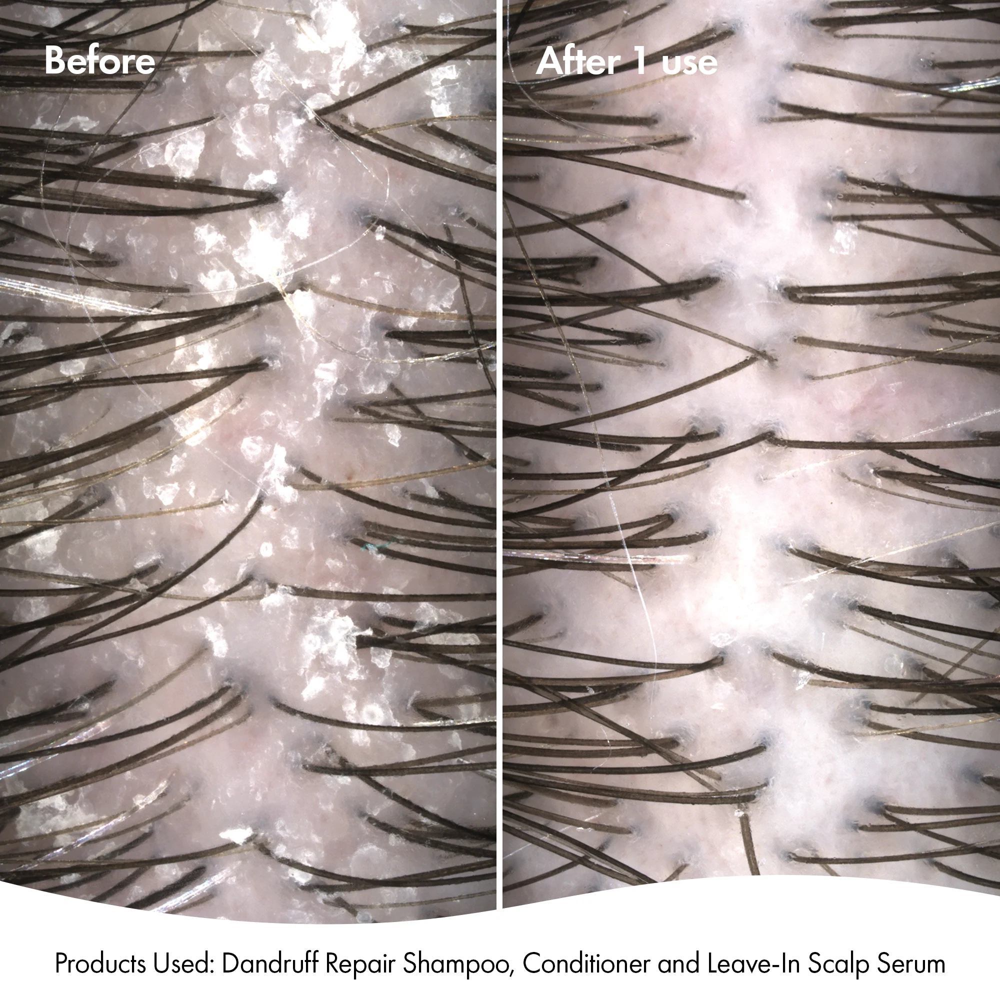 DANDRUFF SHAMPOO - Image 5