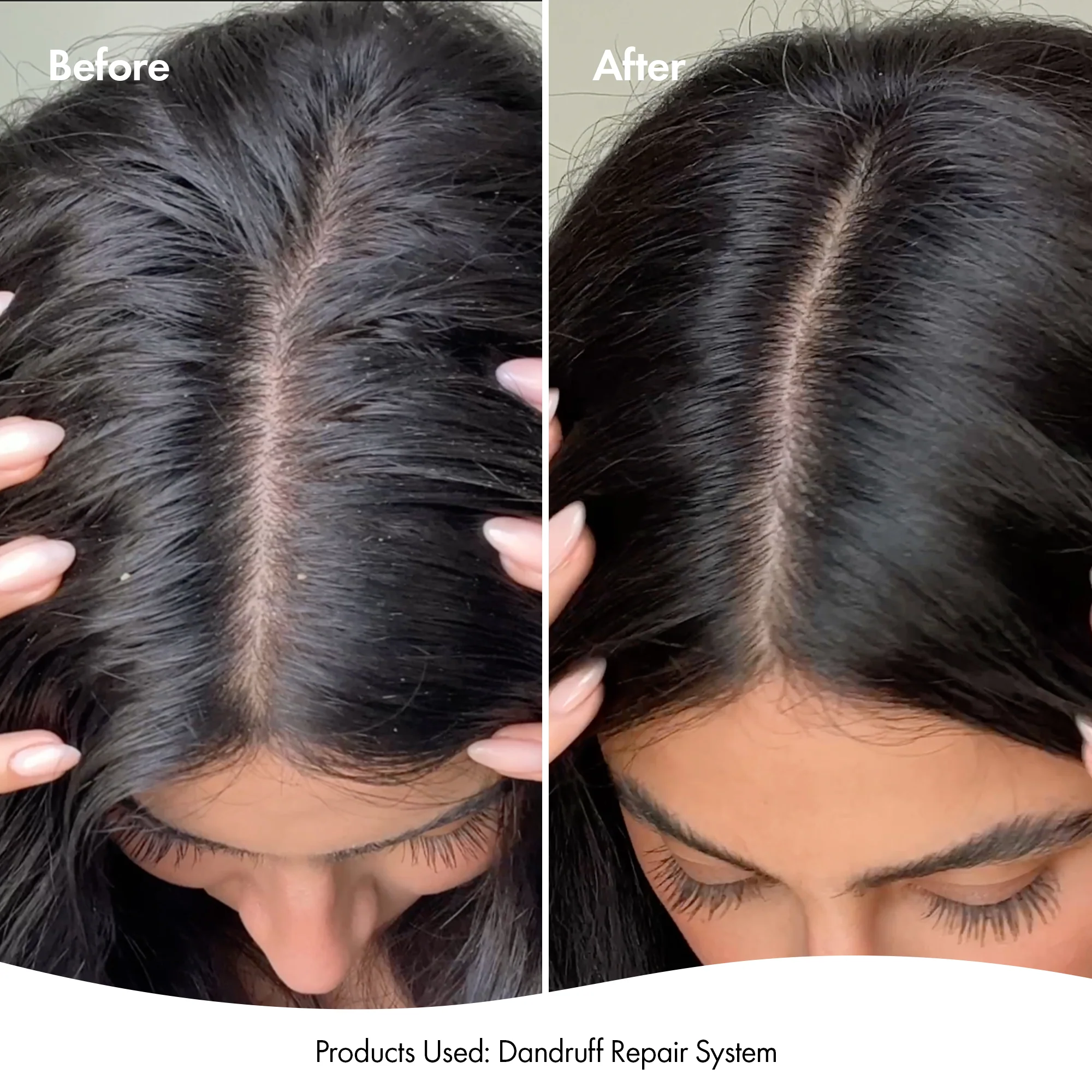 DANDRUFF SHAMPOO - Image 10