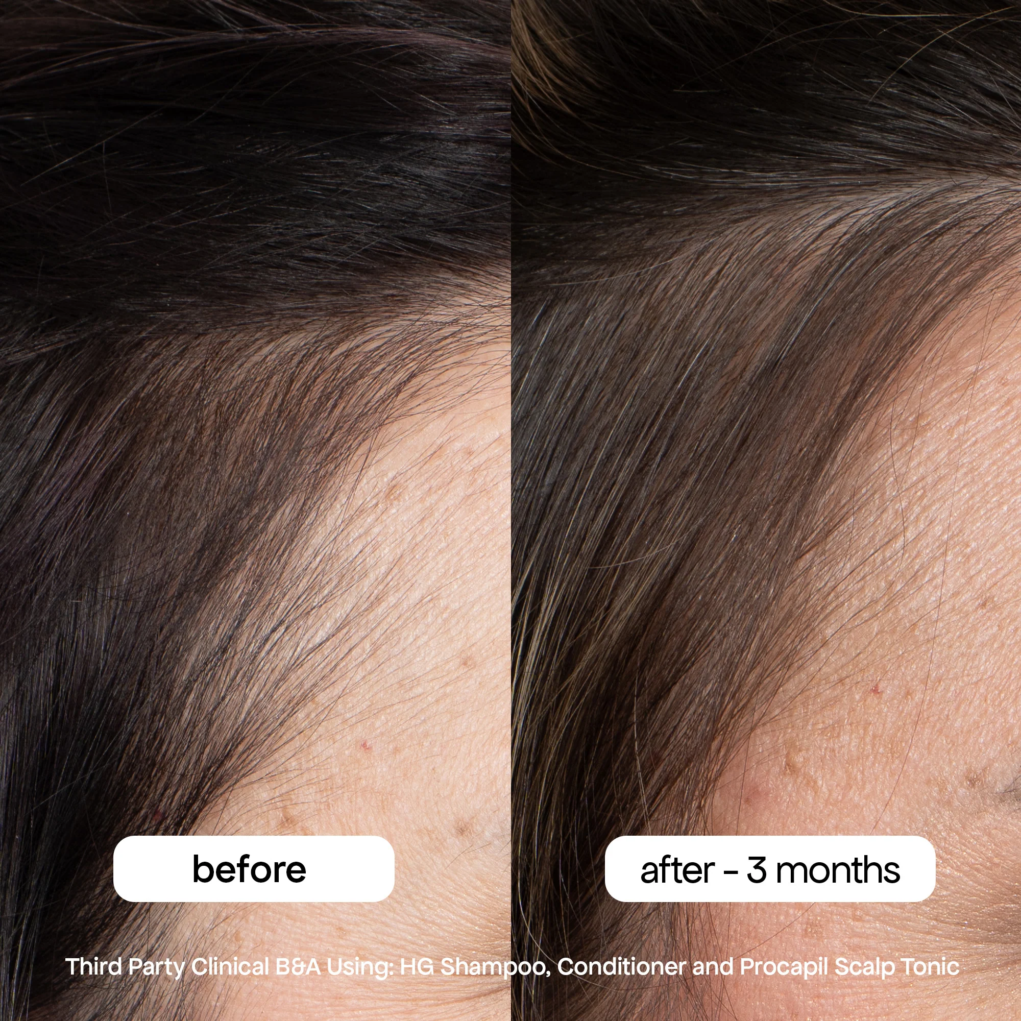 ANTI-THINNING SHAMPOO & CONDITIONER DUO - Image 10