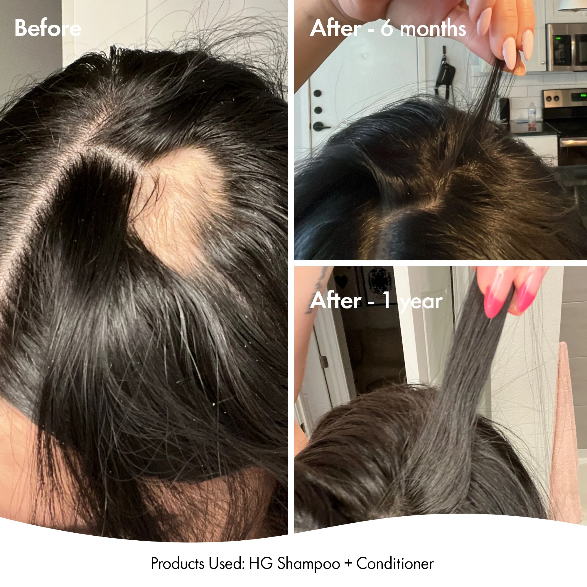 ANTI-THINNING TRIO - Image 4