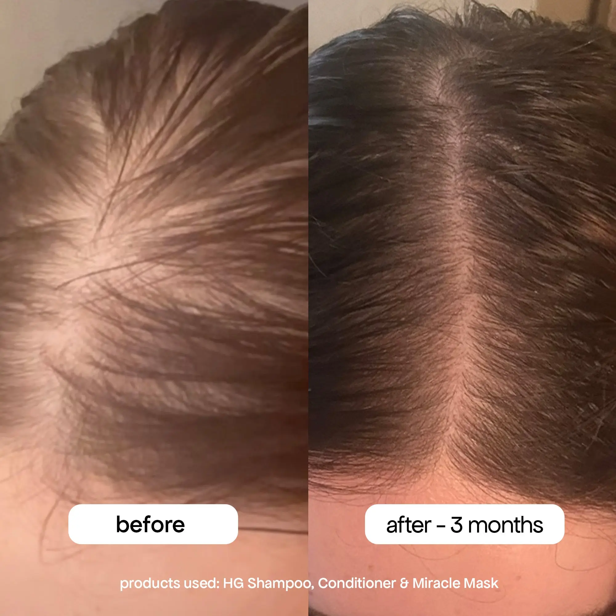 ANTI-THINNING CONDITIONER - Image 7