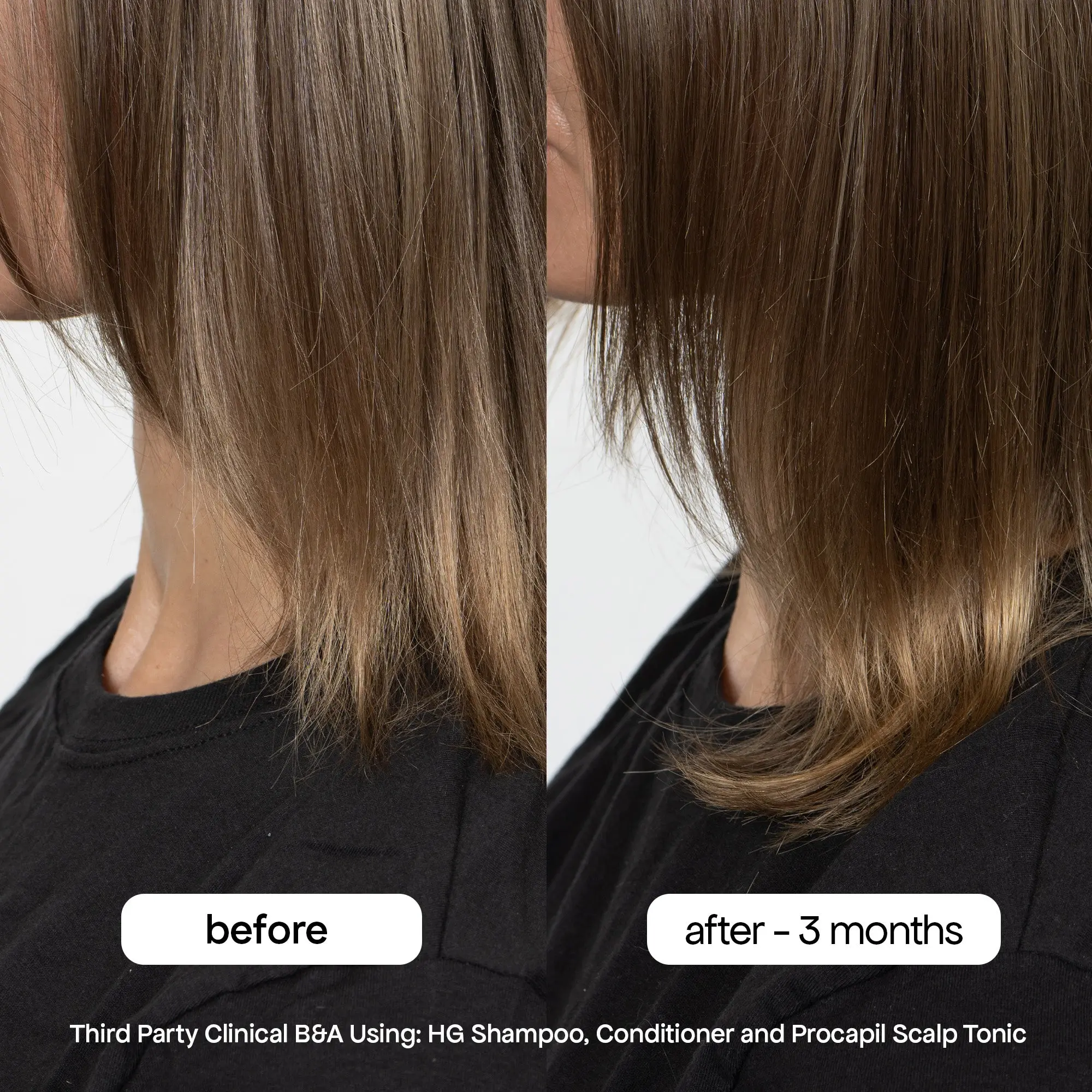 ANTI-THINNING SHAMPOO - Image 5
