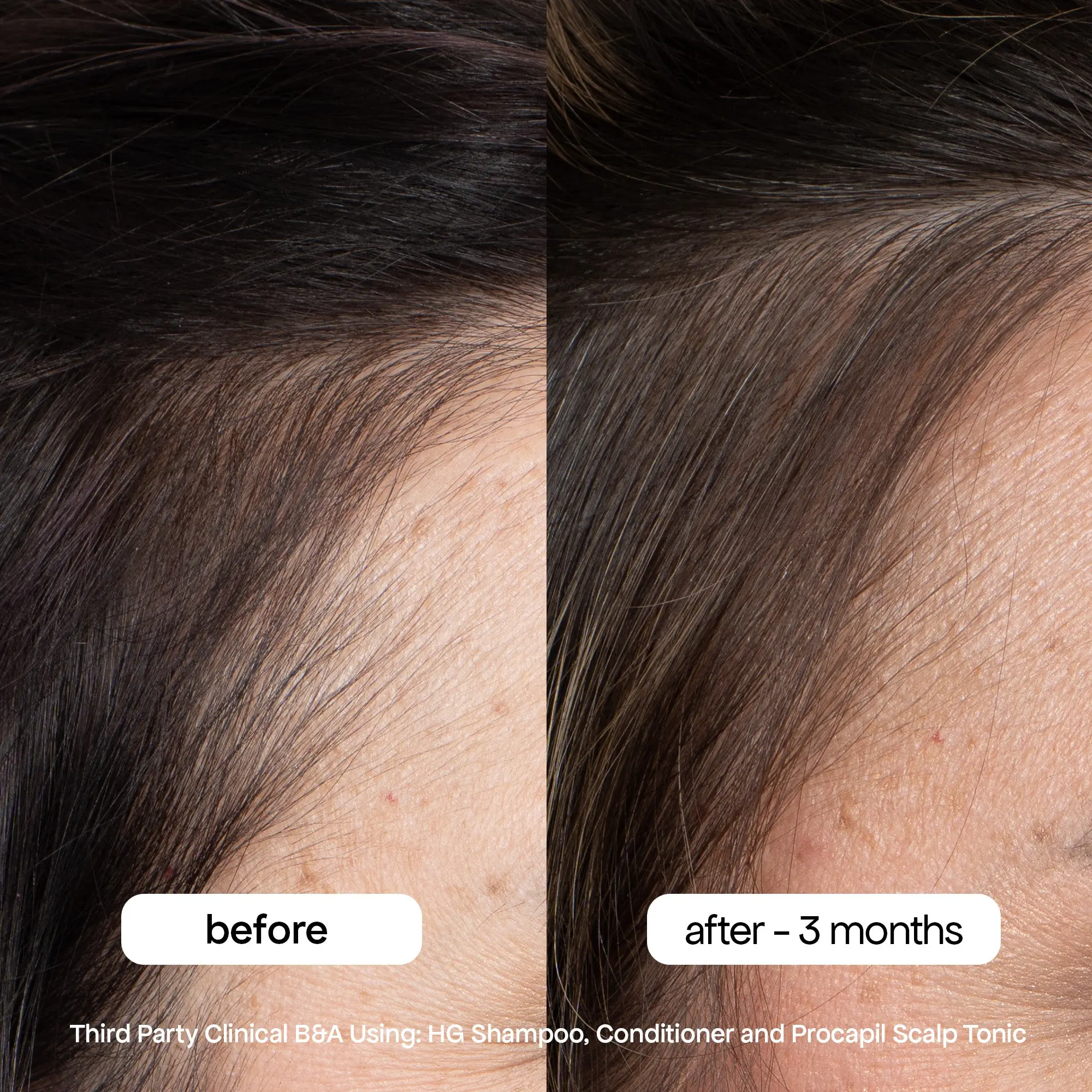 ANTI-THINNING SHAMPOO - Image 6